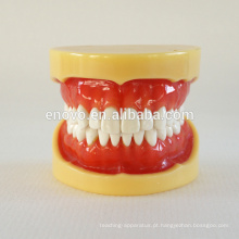 China Medical modelo anatômico dura gomas 28 dentes padrão maxilar dental modelo 13013